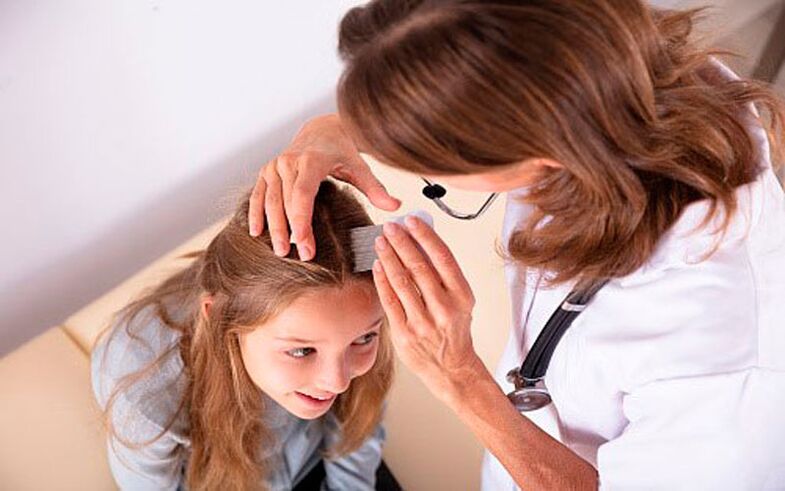 léčba psoriázy hlavy u dětí